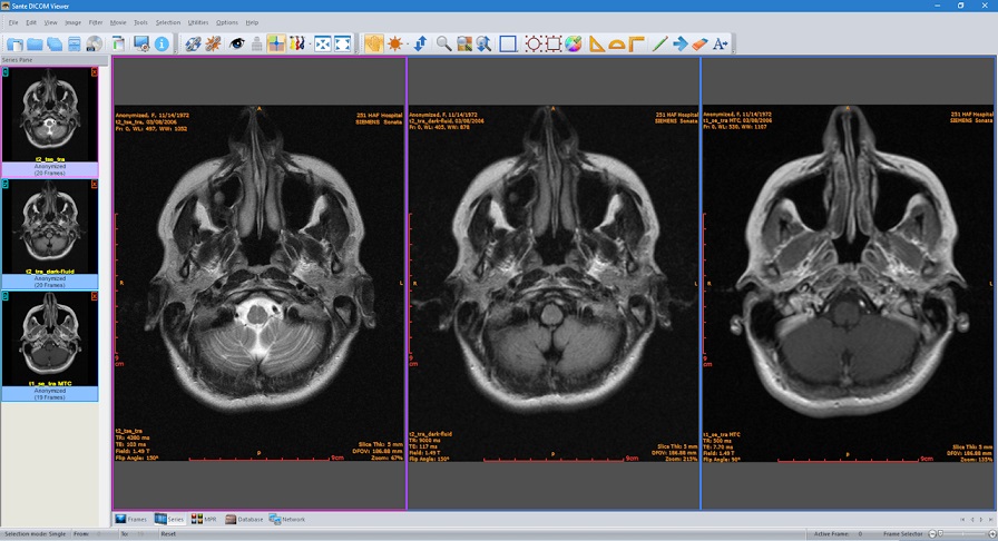 Sante DICOM Viewer Pro 12.1.11 2023 торрент
