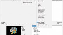 MediaCoder 0.8.61 Build 6010 + Portable